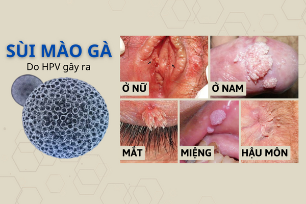 dia-chi-chua-sui-mao-ga-tot-nhat-tai-tp-da-nang-1