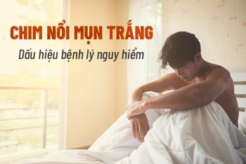 Chim nổi mụn trắng là bị gì nguy hiểm không?