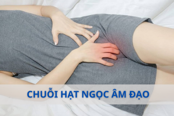 Địa chỉ điều trị chuỗi hạt ngọc âm đạo an toàn, thẩm mỹ