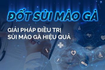 Địa chỉ đốt sùi mào gà ở Quy Nhơn uy tín hiệu quả