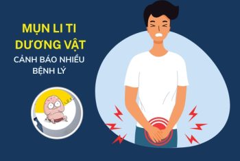 Mụn li ti dương vật có sao không điều trị thế nào?