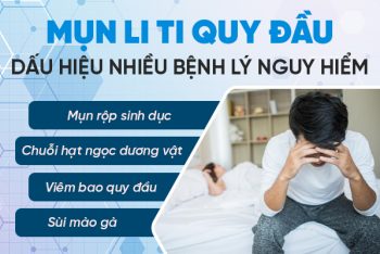 Mụn li ti quy đầu là bị gì nguy hiểm không?