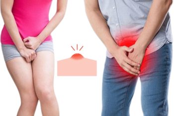 Mụn nhọt vùng kín phải làm sao?