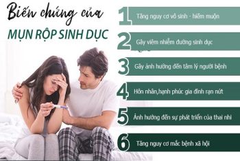 Bệnh viện khám chữa mụn rộp uy tín, an toàn