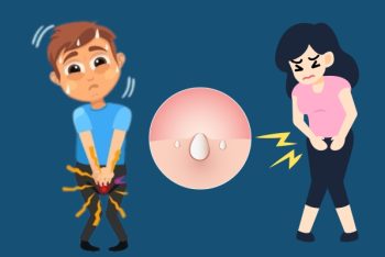 Nguyên nhân mọc mụn trắng sinh dục và cách điều trị