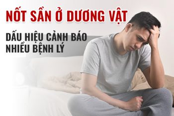 Nốt sần ở dương vật là bị bệnh gì?