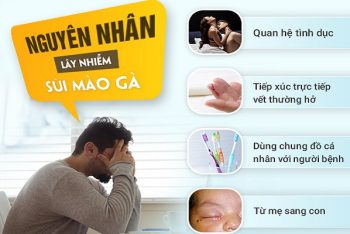 Hình ảnh sùi mào gà dễ nhận ra