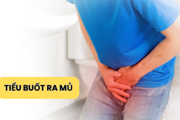 Tiểu buốt ra mủ: Dấu hiệu bệnh xã hội nguy hiểm