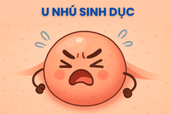 Phương pháp trị u nhú sinh dục hiện đại, hiệu quả nhanh