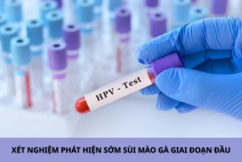 Dấu hiệu sùi mào gà giai đoạn đầu dễ thấy
