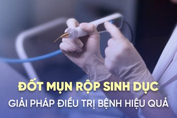 Đốt mụn rộp sinh dục là gì hiệu quả không?