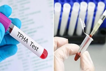 Phòng khám bệnh giang mai nhanh chóng, chuẩn xác, trị hiệu quả