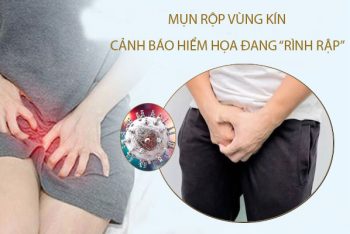 Mụn rộp vùng kín “cảnh báo” hiểm họa đang “rình rập”