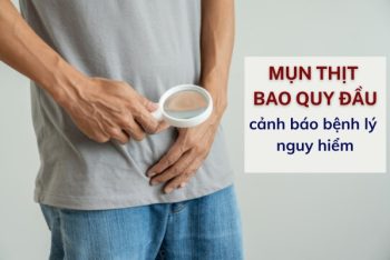 5 nguyên nhân gây nổi mụn thịt bao quy đầu mà bạn không ngờ đến