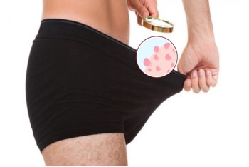 Nam giới bối rối vì nổi mụn thịt dương vật? Cách xử lý an toàn, nhanh gọn đây rồi!