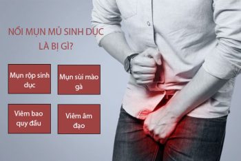 Nổi mụn mủ sinh dục là bị gì?
