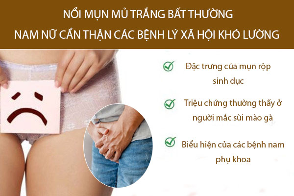 Nổi mụn mủ trắng bất thường – Nam nữ cẩn thận các bệnh lý xã hội khó lường