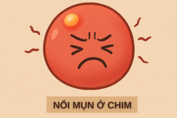 Nổi mụn ở chim là biểu hiện bệnh xã hội nguy hiểm