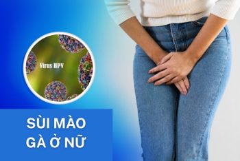 Dấu hiệu sùi mào gà ở nữ và cách điều trị