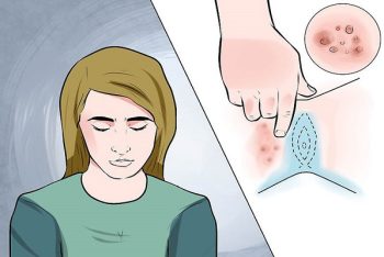 Nơi khám trị sùi mào gà ở vùng kín hiệu quả