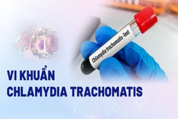 Cách điều Trị Chlamydia hiện đại, hiệu quả nhanh