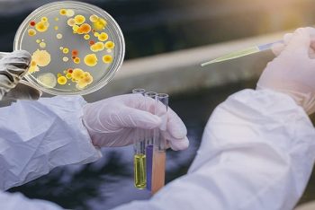 Địa chỉ xét nghiệm Chlamydia nhanh chuẩn và điều trị hiệu quả