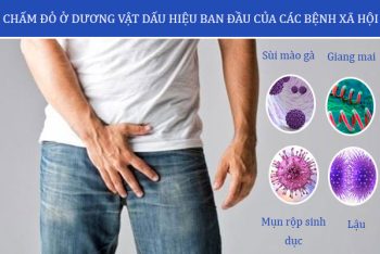 Chấm đỏ ở dương vật – Cảnh báo sớm các bệnh xã hội nguy hiểm!