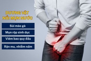 Dương vật nổi mụn nước là bệnh gì? Cẩn thận với biến chứng khó lường