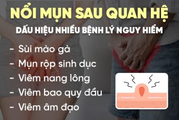 Nổi mụn sau quan hệ cảnh báo 5 bệnh lý nguy hiểm khó ngờ