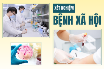 Khi nào nên đi xét nghiệm bệnh xã hội?