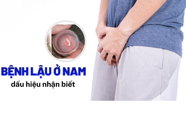 dau-hieu-benh-lau-o-nam (1)