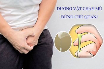 Dương vật chảy mủ là dấu hiệu bệnh gì? Đừng chủ quan!