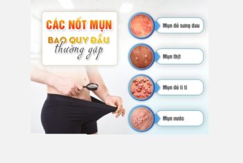 Mụn bao quy đầu là bị bệnh gì nguy hiểm không?