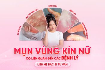 Giật mình với 5 nguyên nhân gây mụn vùng kín nữ bạn không ngờ tới