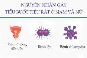 Tiểu buốt tiểu rát: Dấu hiệu cảnh báo cơ thể đang gặp nguy hiểm