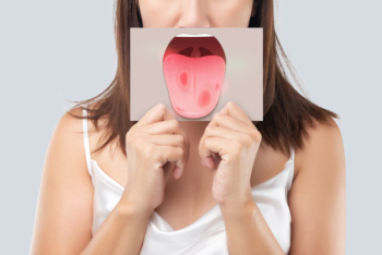 Quan hệ bằng miệng lây bệnh xã hội phải không?