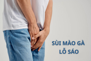 Dấu hiệu sùi mào gà lỗ sáo dễ nhận biết