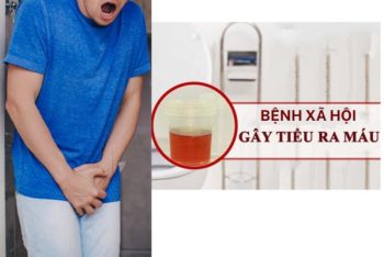 Tiểu ra máu là dấu hiệu bệnh gì? Coi chừng mắc 1 trong 5 bệnh nguy hiểm sau!