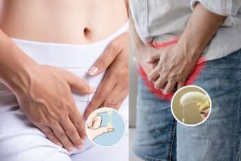 Vùng kín ra dịch là bệnh gì nguy hiểm không?